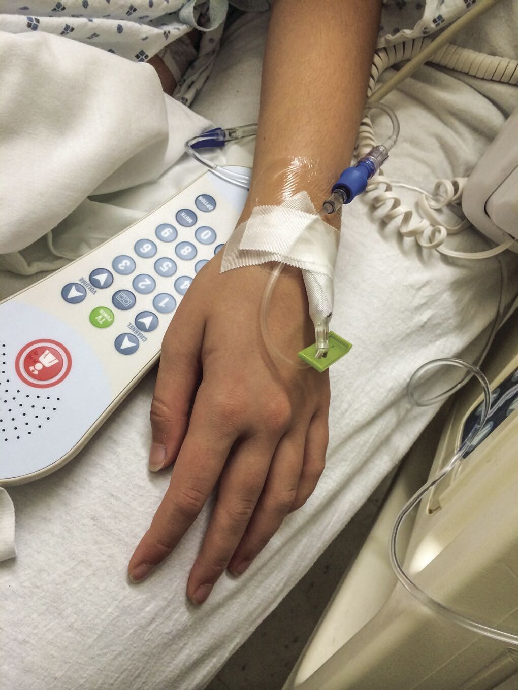 People with rare diseases have poor health-related quality of life, OSU study finds